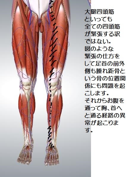 なんでオスグッドが治らない 御薗治療院