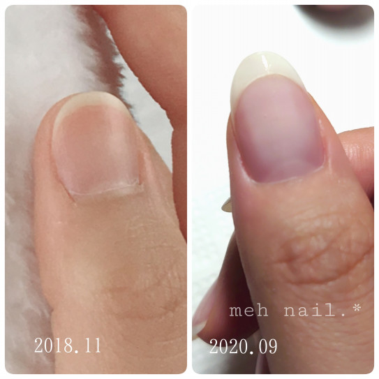 爪は変わっていきます 福岡市 博多 祇園 川端 ネイルサロン Meh Nail