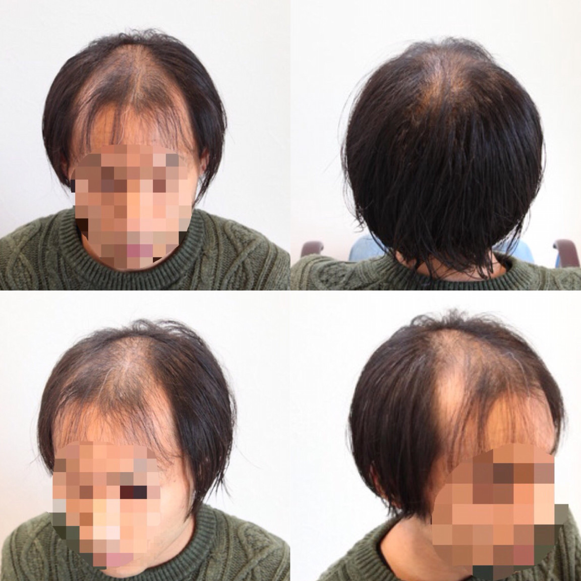 後編 実践編 究極のヘアセット タイプ別 ソフトマッシュ編 Inti