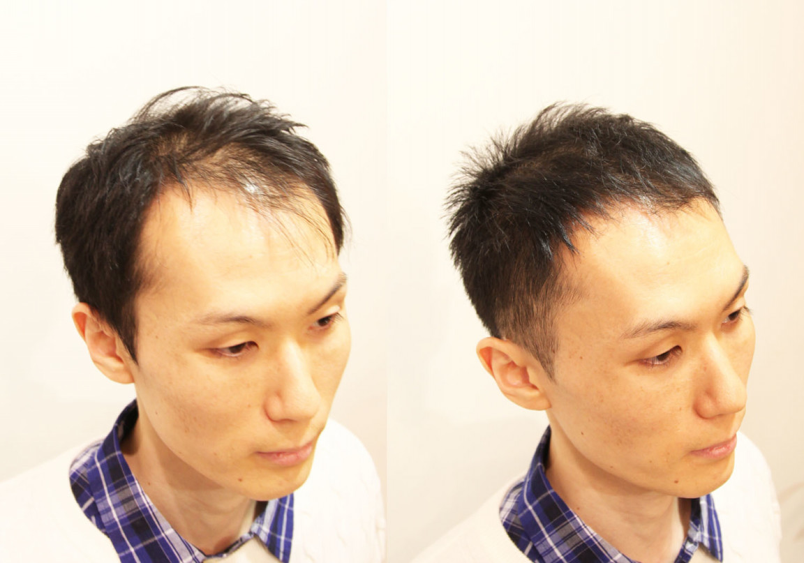 薄毛髪型 実録 前髪がかなり薄くなってしまっても薄毛をカバーできるヘアスタイルはきっとある Inti Report 薄毛に悩む男性 の為の美容院 Inti インティ 全席個室 東京 大阪 福岡に展開