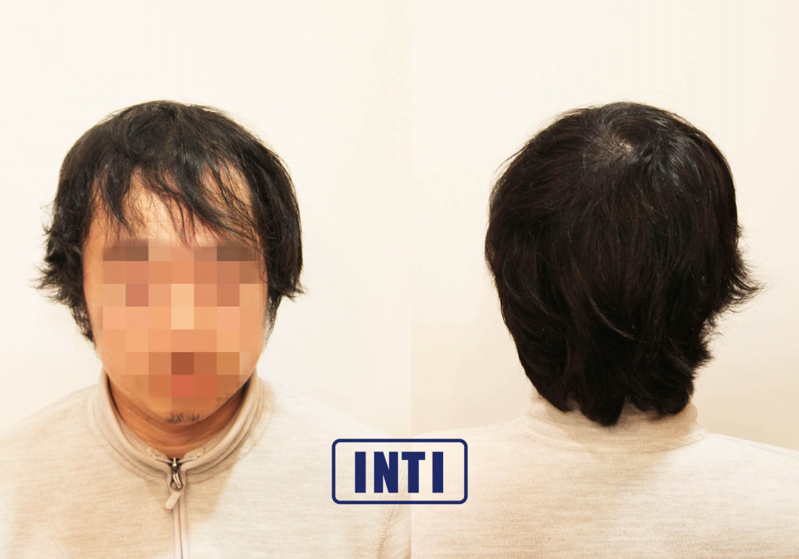 軟毛 くせ毛 薄毛 に悩むモデルのくせ毛を活かす Inti Report