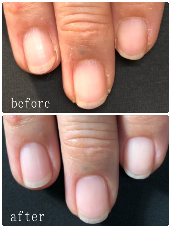 ネイルケアメニュー 横浜市 神奈川区 新子安 深爪 リリーブ ネイルサロン ネイルスクール パラジェル