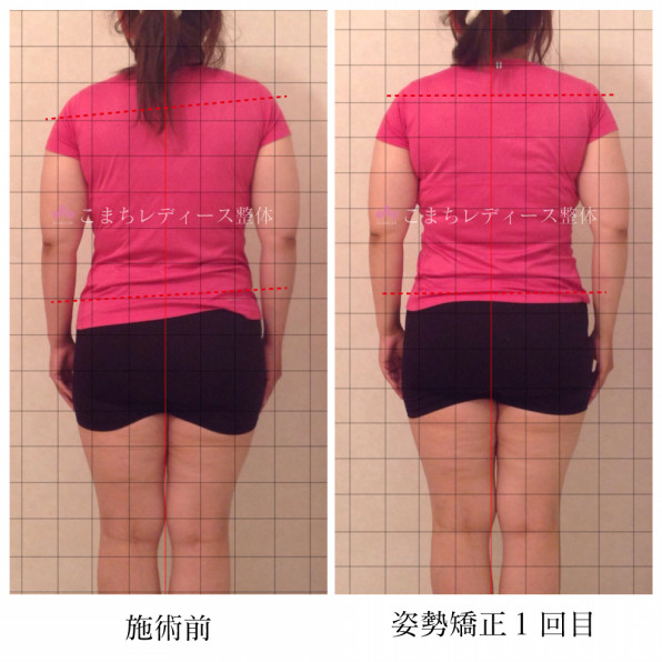 肩の高さが違う原因は 肩の問題ではありません いい顔 いい骨 いい人で