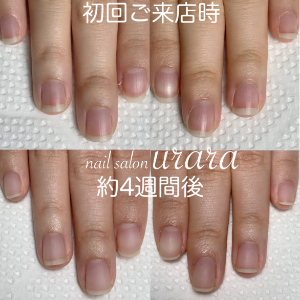 自爪育成とは 福岡市西区姪浜 Nail Salon Urara ネイルサロンうらら