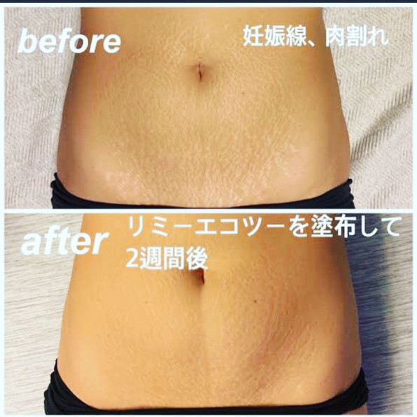 医療レベルの凄い商品入荷しました Beauty Health Viviana 医療レベルの凄い商品入荷しました Beauty Health Viviana