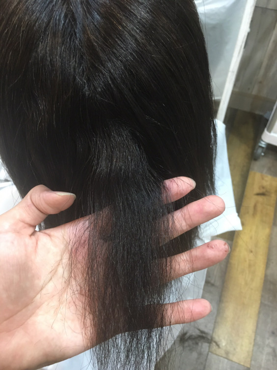 髪がジリジリから1年半 Umichel