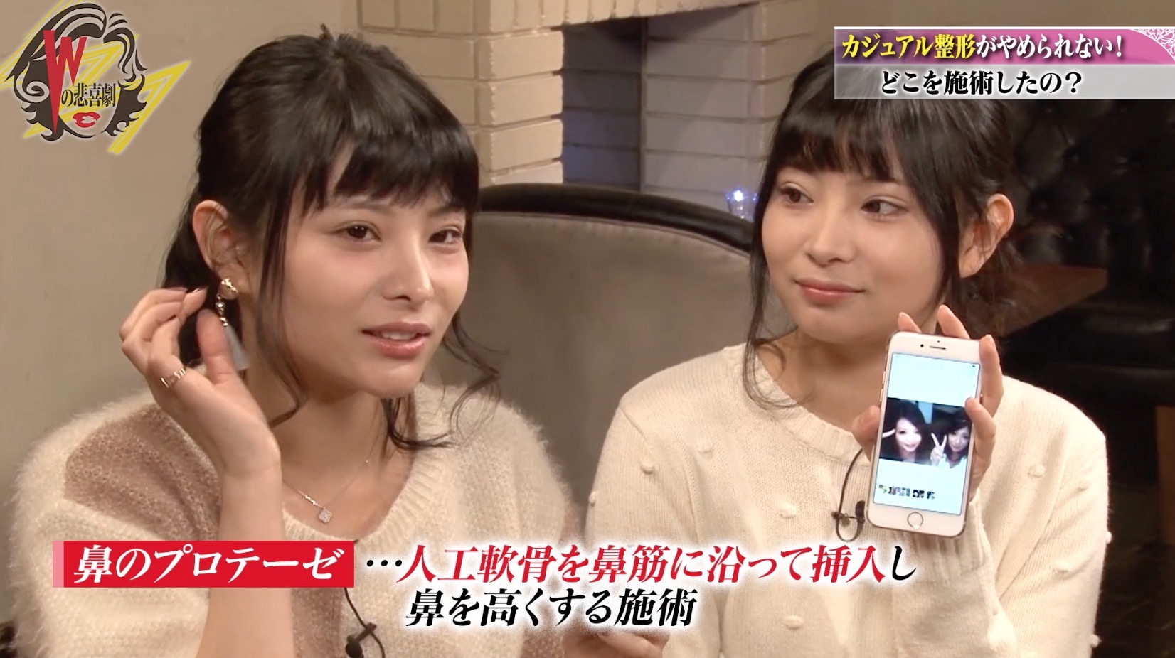 一卵性の双子アイドル、美容整形のきっかけは「また似てるねって言われたくて…」 AbemaTIMES