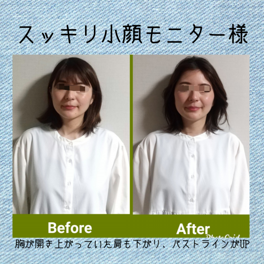 スッキリ小顔Before/After | ～おうちサロン～ ドライヘッドスパ にこり