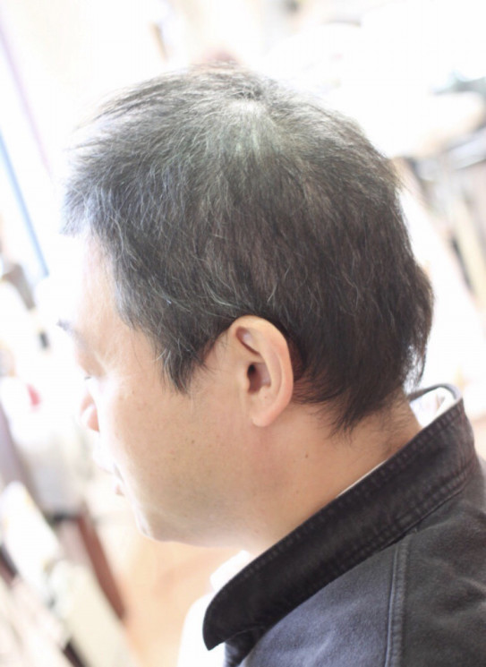 抗がん剤後に出て来たクセ毛は元に戻るのか Mさんの場合 江東区北砂美容室 江東区亀戸美容室 One S Place 癌サバイバー美容師 相澤一也のブログ 抗がん剤後に出て来たクセ毛は元に戻るのか Mさんの場合 江東区北砂美容室 江東区亀戸美容室 One S Place 癌サバイバー美容師 相澤一也のブログ