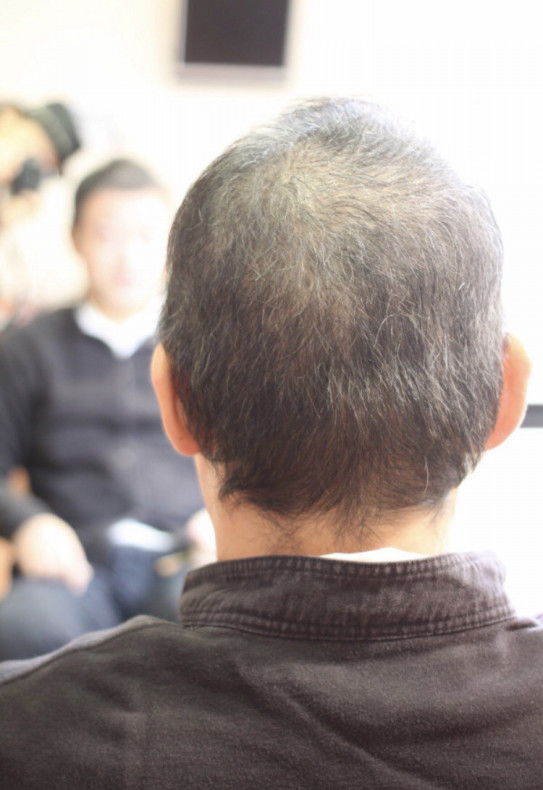 抗がん剤後に出て来たクセ毛は元に戻るのか Mさんの場合 江東区北砂美容室 江東区亀戸美容室 One S Place 癌サバイバー美容師 相澤一也のブログ 抗がん剤後に出て来たクセ毛は元に戻るのか Mさんの場合 江東区北砂美容室 江東区亀戸美容室 One S Place 癌サバイバー美容師 相澤一也のブログ