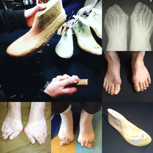 自分の足に合わない木型で作られた靴 静岡 藤枝 焼津 完全フルオーダーメイドシューズ 靴 友樹 自分の足に合わない木型で作られた靴 静岡 藤枝 焼津 完全フルオーダーメイドシューズ 靴 友樹