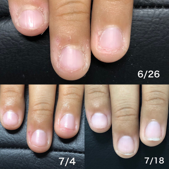 小学生の息子 地爪育成中 Emerry Nail