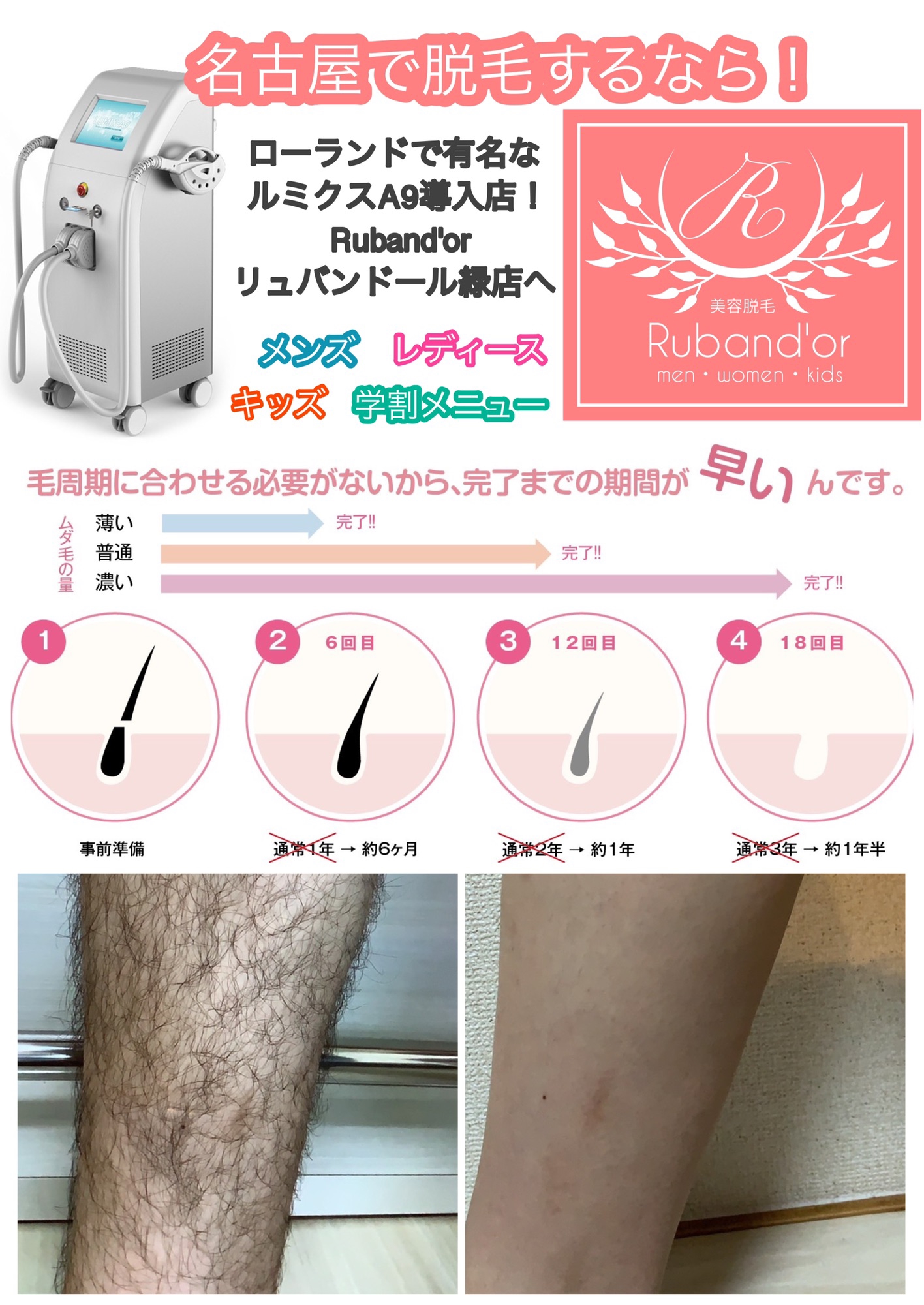 ルミクス脱毛とは？ | 名古屋・都度払いOK! ルミクス美容脱毛 Ruband