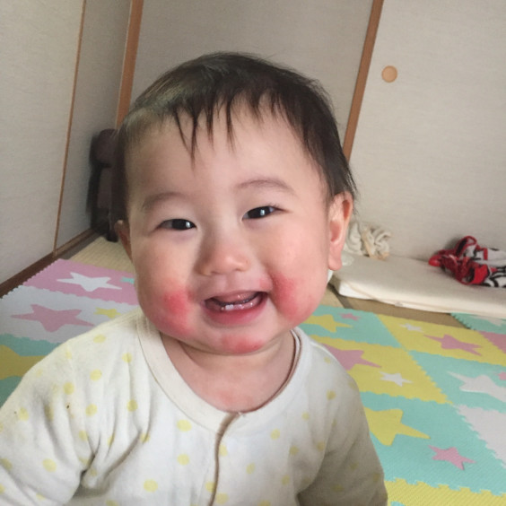 ほっぺが真っ赤 育 児 日 記 ほっぺが真っ赤 育 児 日 記