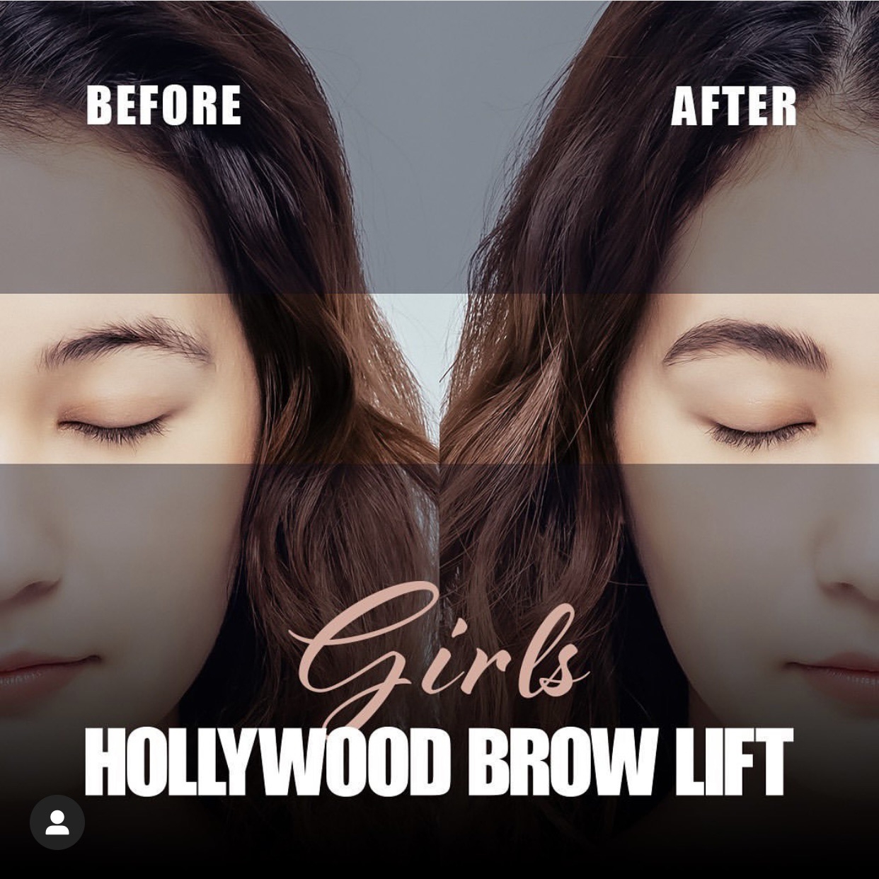 沼津】HOLLYWOOD BROW LIFT