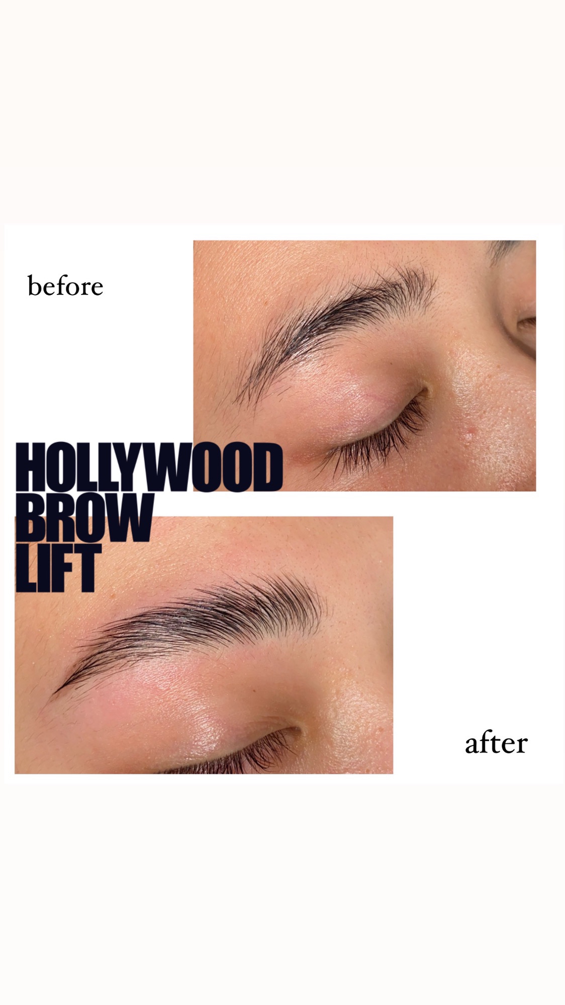 沼津】HOLLYWOOD BROW LIFT