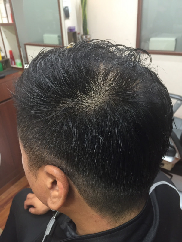 男性の薄毛対策のヘアスタイル 大東市理容店 Hair Salon Kurisu 平日予約で19時30 21時まで営業中