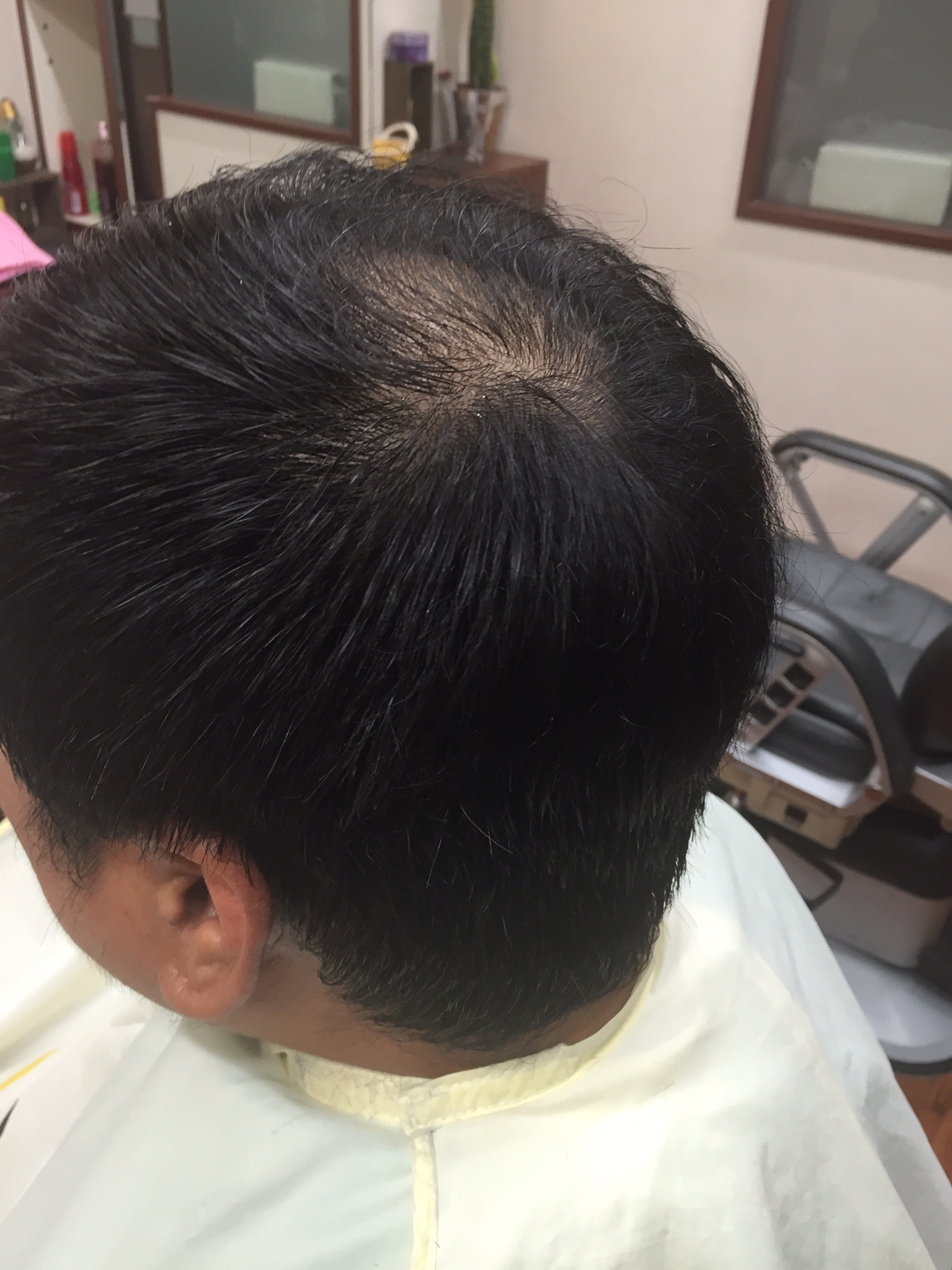 男性の薄毛対策のヘアスタイル 大東市理容店 Hair Salon Kurisu 平日