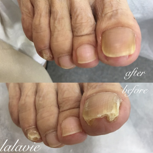 フットケア 足の爪切り お掃除ケア 札幌 ネイル フットケアサロンlalavie ララヴィー