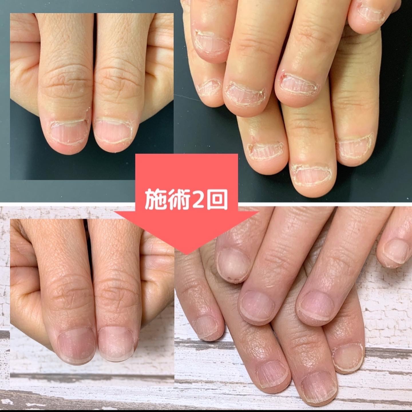 深爪男様 リクエスト 2点 まとめ商品 67d995337a87d32c81aa6d38a3803f