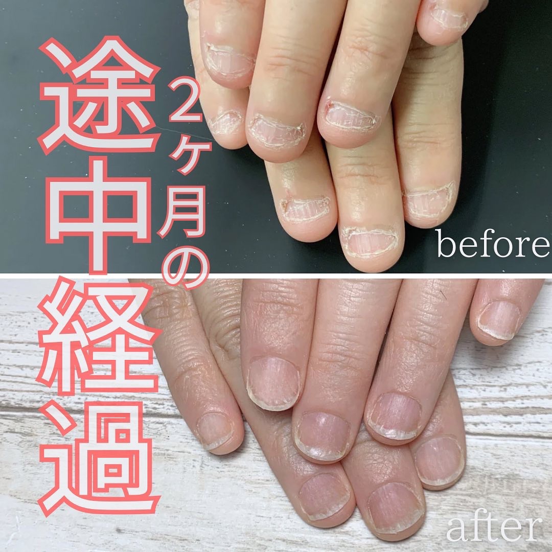深爪男様 リクエスト 2点 まとめ商品 a1b0f1c768f7000220f8198c72daac