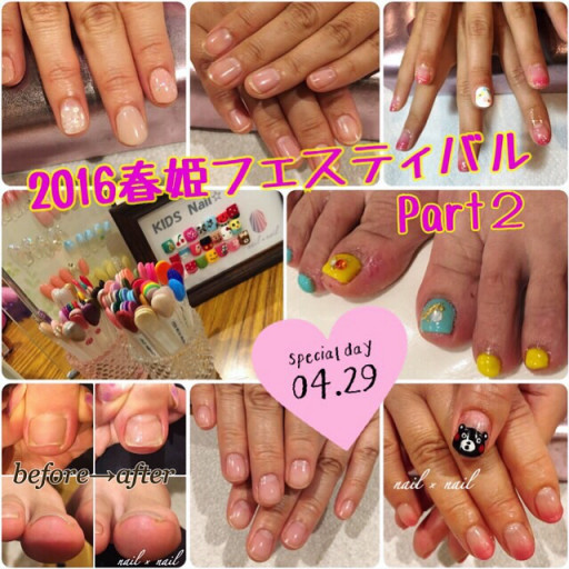 2016年04月の記事一覧 ページ1 Nail Nail 巻爪補正とジェルネイル