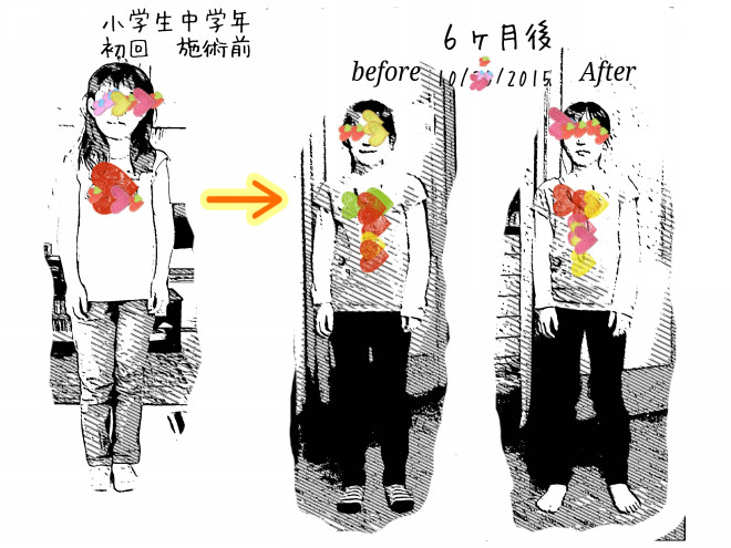 Beforeafter 子どもの成長は著しい Manual Remedy