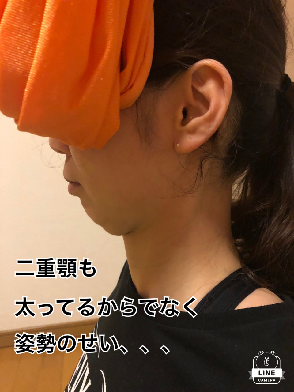 二重顎は太ってるせいじゃない 鳥取市のエアリアルヨガ 空中ヨガ 教室natural 楽しく体幹 筋トレ 姿勢改善