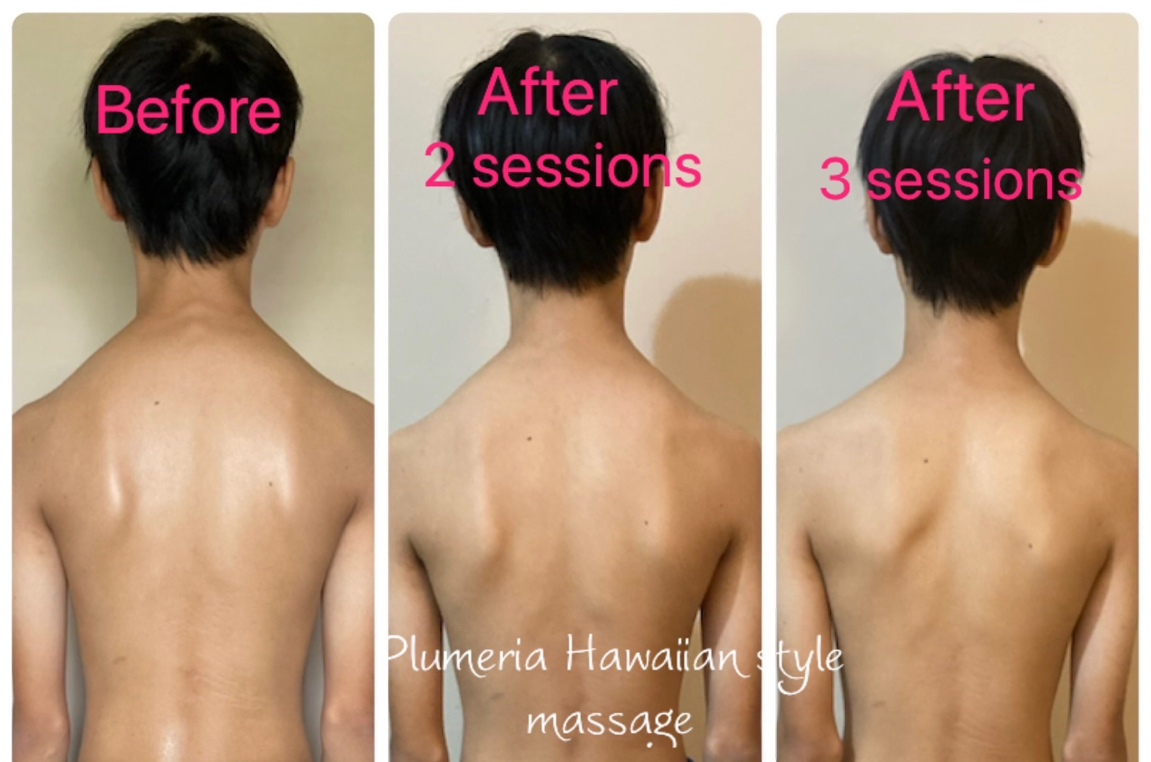 13yo Boy Client Plumeria Hawaiian Style Massage   03f57bfec480603e87e965c53c322bc0 E82e168a78a0c3ed56f20ac31783cd3c 