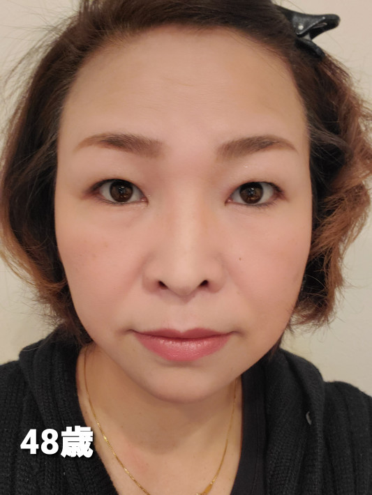 年って顔の印象がずいぶん変わる エステティックサロン Apprici アプリシー 年って顔の印象がずいぶん変わる エステティックサロン Apprici アプリシー