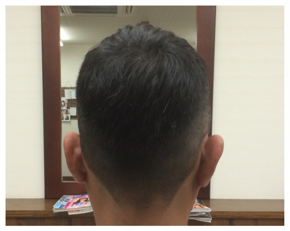 今日は暑すぎ 刈り上げ メンズ Link Hair Design 愛媛県西条市の美容室 今日は暑すぎ 刈り上げ メンズ Link Hair Design 愛媛県西条市の美容室