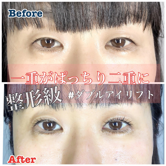 整形級の施術がまつ毛サロンで受けられますよ Eyelashsalon Althaea