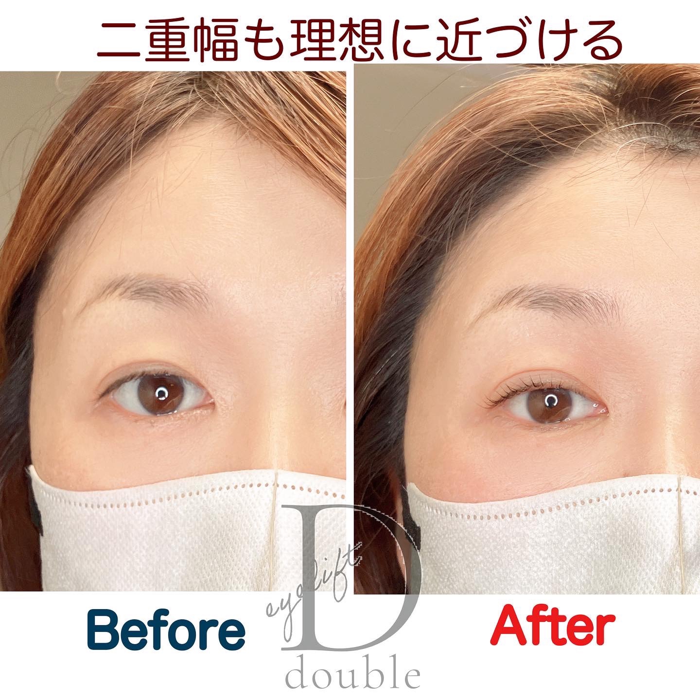 二重さんも年齢瞼のお悩みにはコレ | Eyelash&Eyeblow ALTHAEA