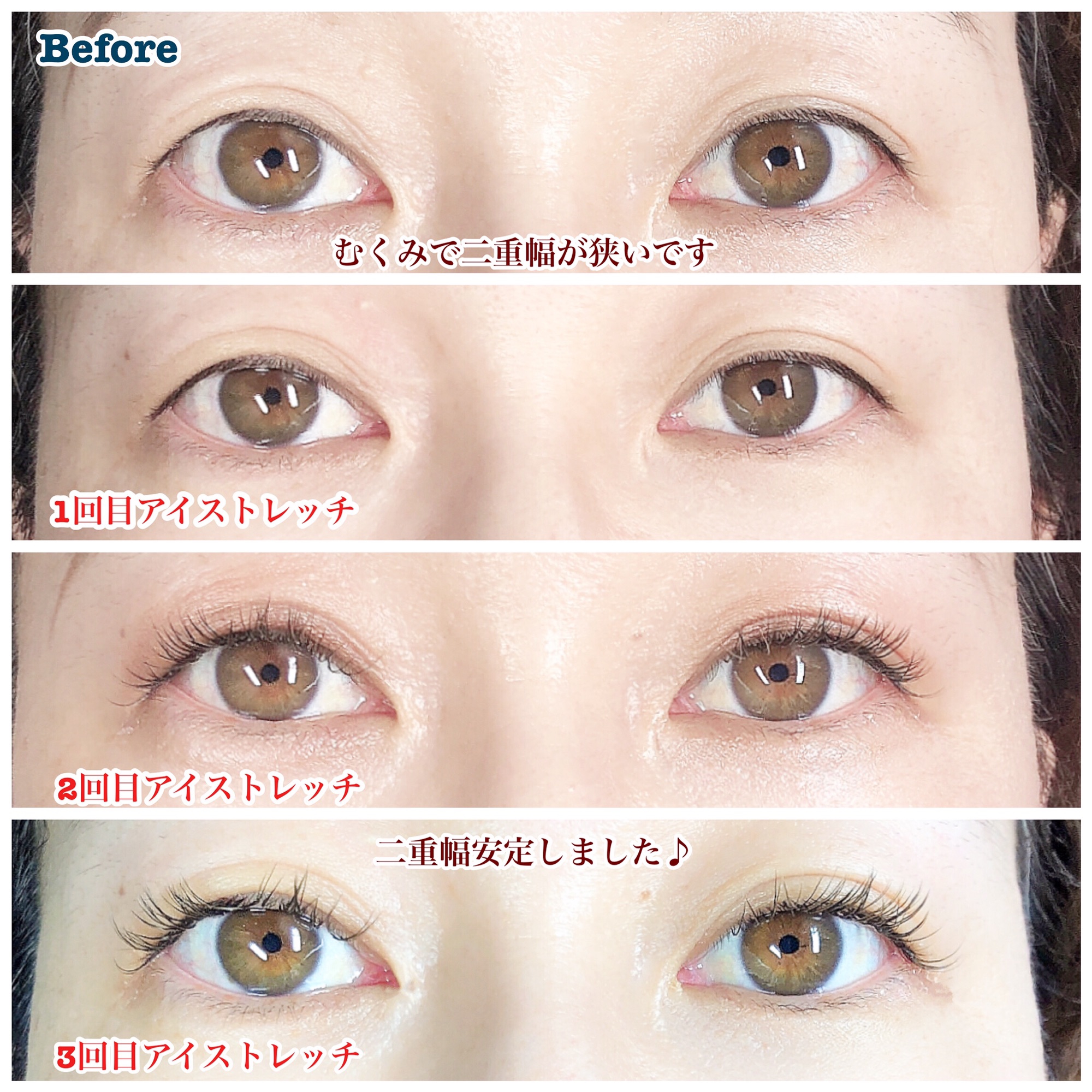 二重幅が定着 Eyelashsalon Althaea