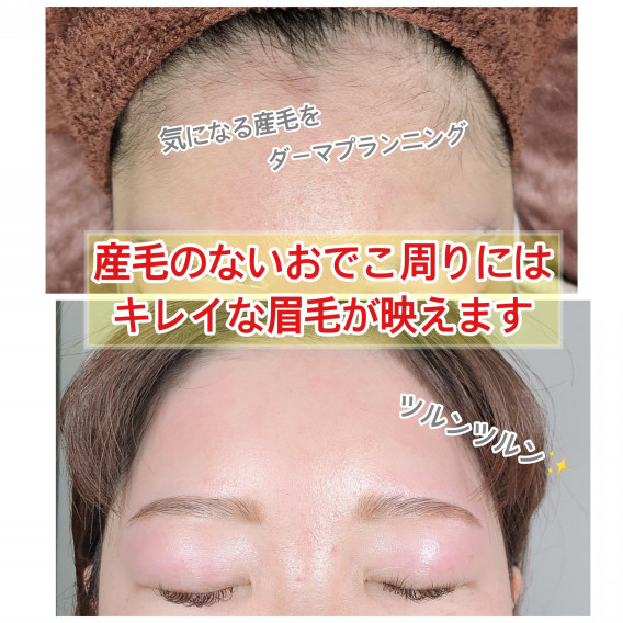 まるで別人のようにツルツルに Eyelashsalon Althaea