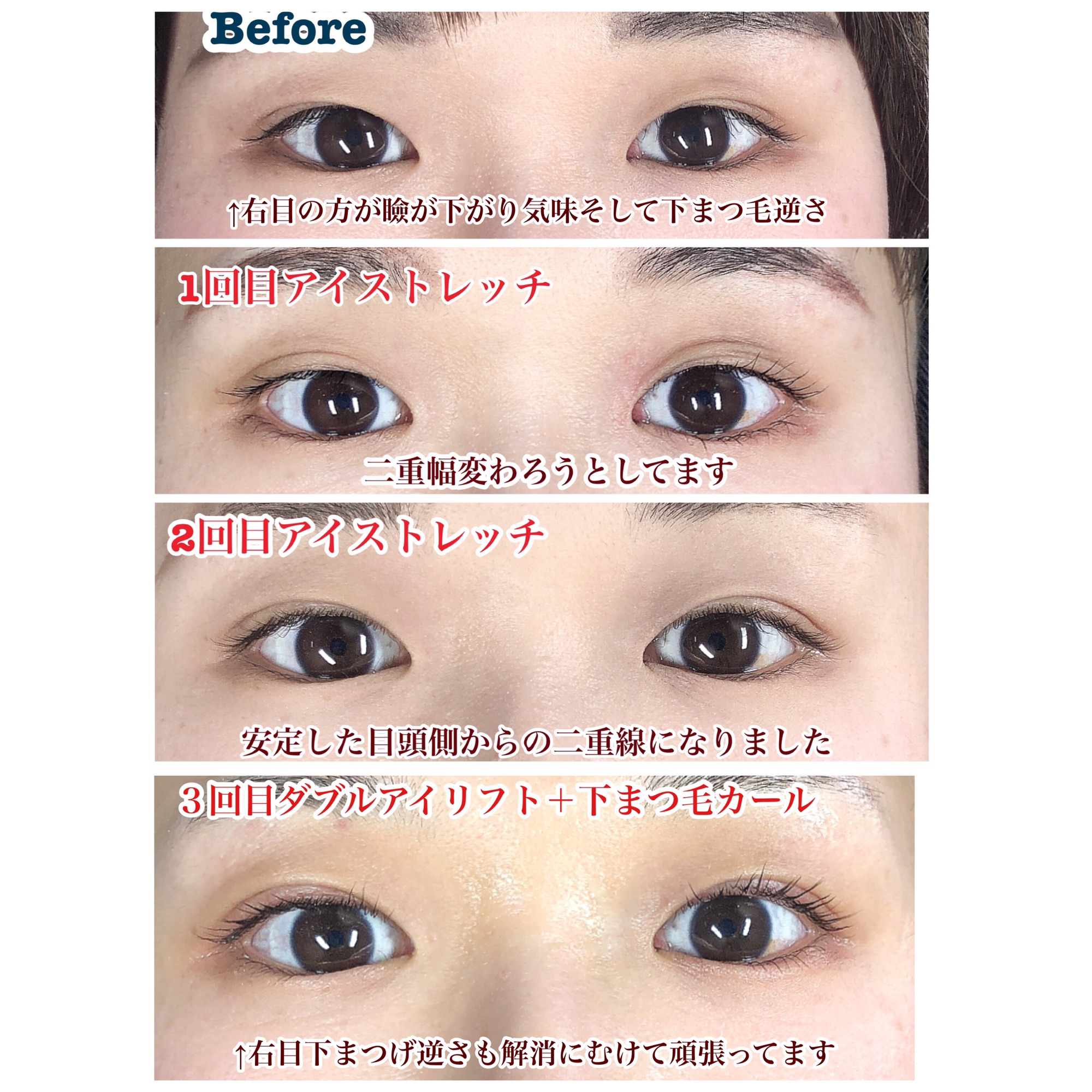 目の開きが全然ちがう！ | Eyelash&Eyeblow ALTHAEA