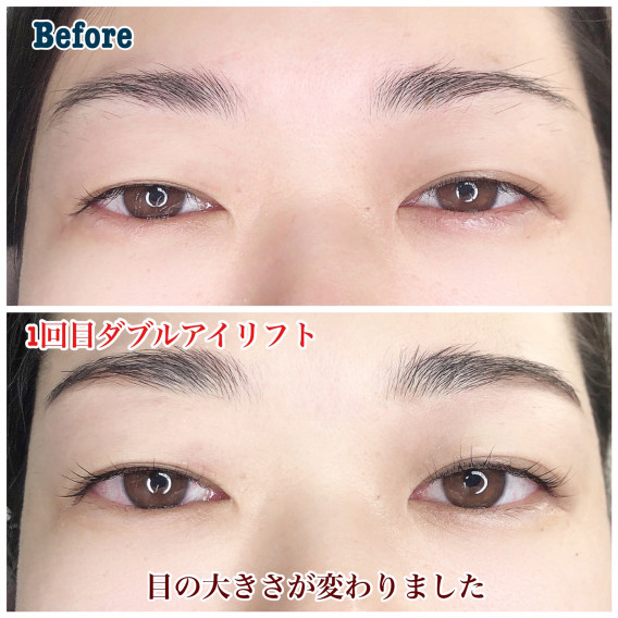 目が大きくなる人続出 Eyelashsalon Althaea 目が大きくなる人続出 Eyelashsalon Althaea