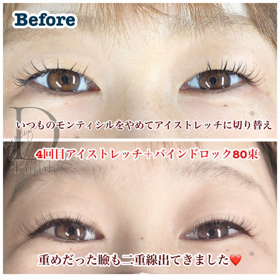 整形なしで二重線定着させましょ Eyelash Eyeblow Althaea