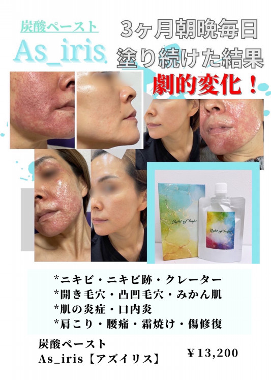 正規取扱代理店 As_iris【アズイリス】炭酸パック | 毛穴改善・肌質 