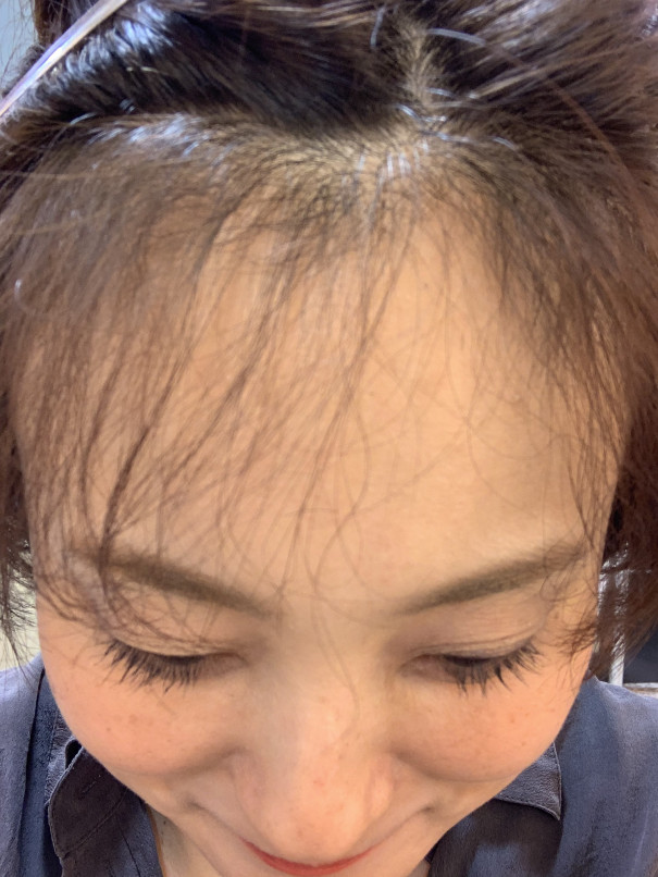 チリチリの季節 ほんわかブログ チリチリの季節 ほんわかブログ