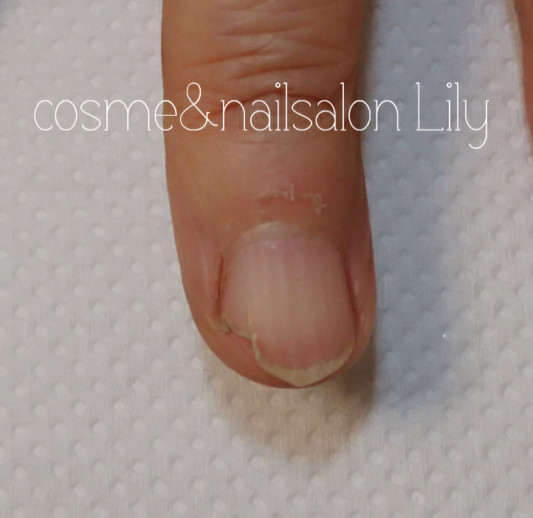 自爪が弱いというお悩み Nails Lily ネイルズリリィ