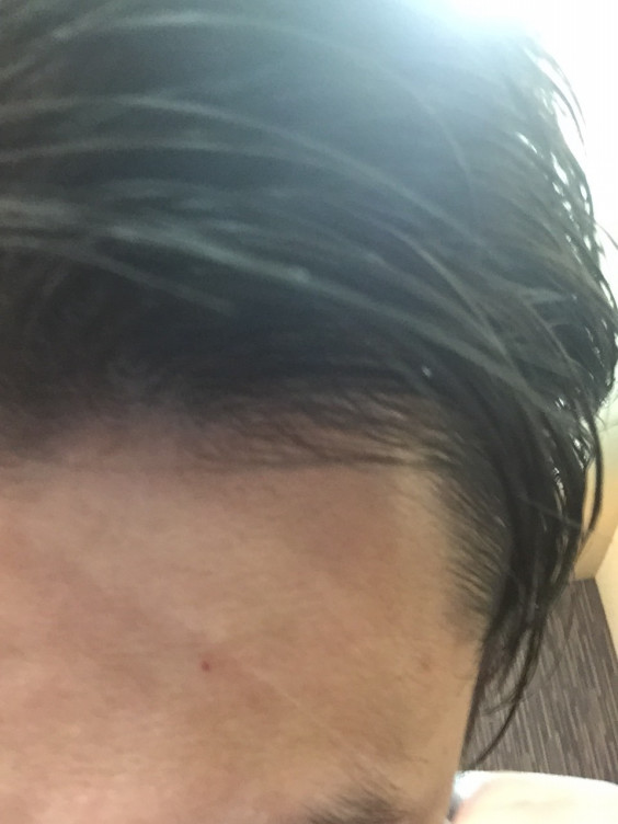 福毛と言われてもなぁ Worth Hair Room S Blog 福毛と言われてもなぁ Worth Hair Room S Blog