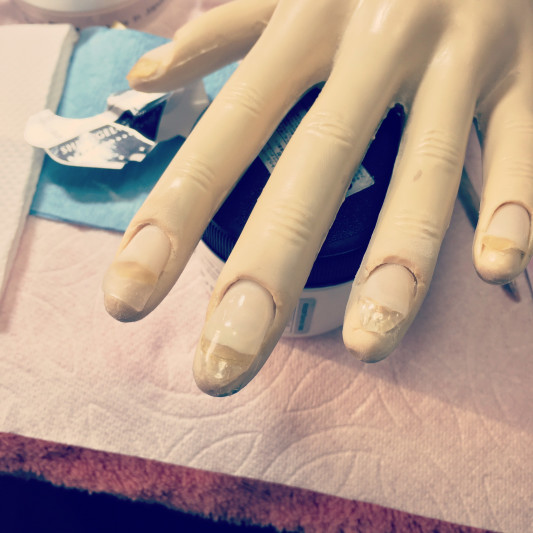 深爪矯正講習 神奈川県藤沢市の深爪 美爪育成ネイルサロン
