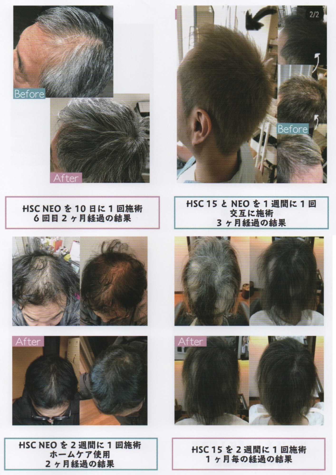 強髪プログラム　HSC15