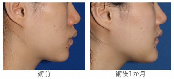 女優さんの様なフェイスラインになりたい 自分がもっと好きになる 宮崎邦夫 湘南美容外科クリニック技術教育 医療安全責任者 新宿本院骨切りチームドクター