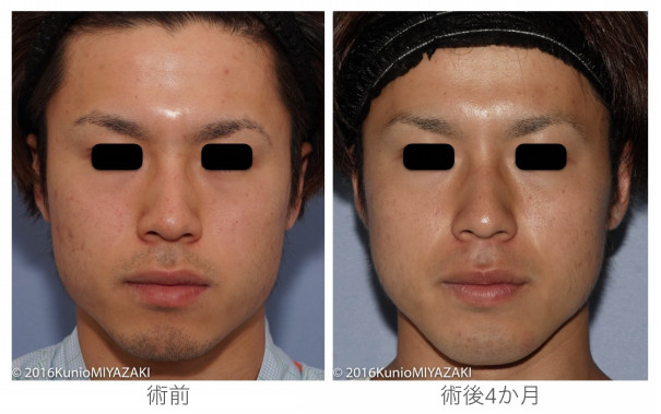 フェイスラインをすっきりと 自分がもっと好きになる 宮崎邦夫 湘南美容外科クリニック技術教育 医療安全責任者 新宿本院骨切りチームドクター
