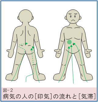 始原はり施術 | はりすと＝ちゃりすと