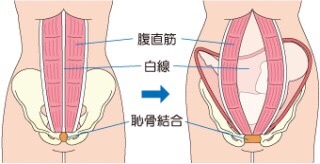 お腹にボール落とすトレーニングは間違っている カラダ喜ぶ情報発信サイト