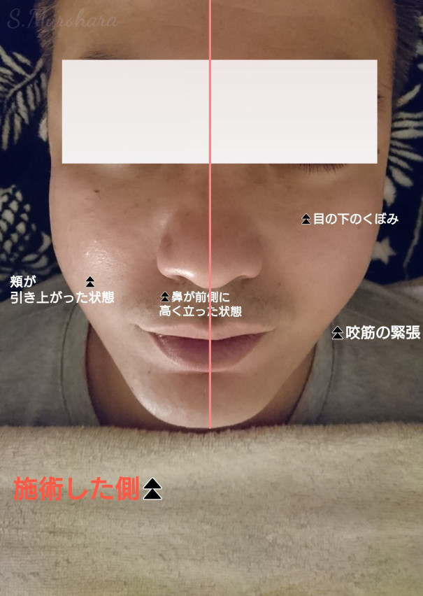 頬 鼻 の歪みと 目の下のくぼみ はワンセット むろはらしづこのハートから美しさが溢れ出すフェイス ボディケア 頬 鼻 の歪みと 目の下のくぼみ はワンセット むろはらしづこのハートから美しさが溢れ出すフェイス ボディケア
