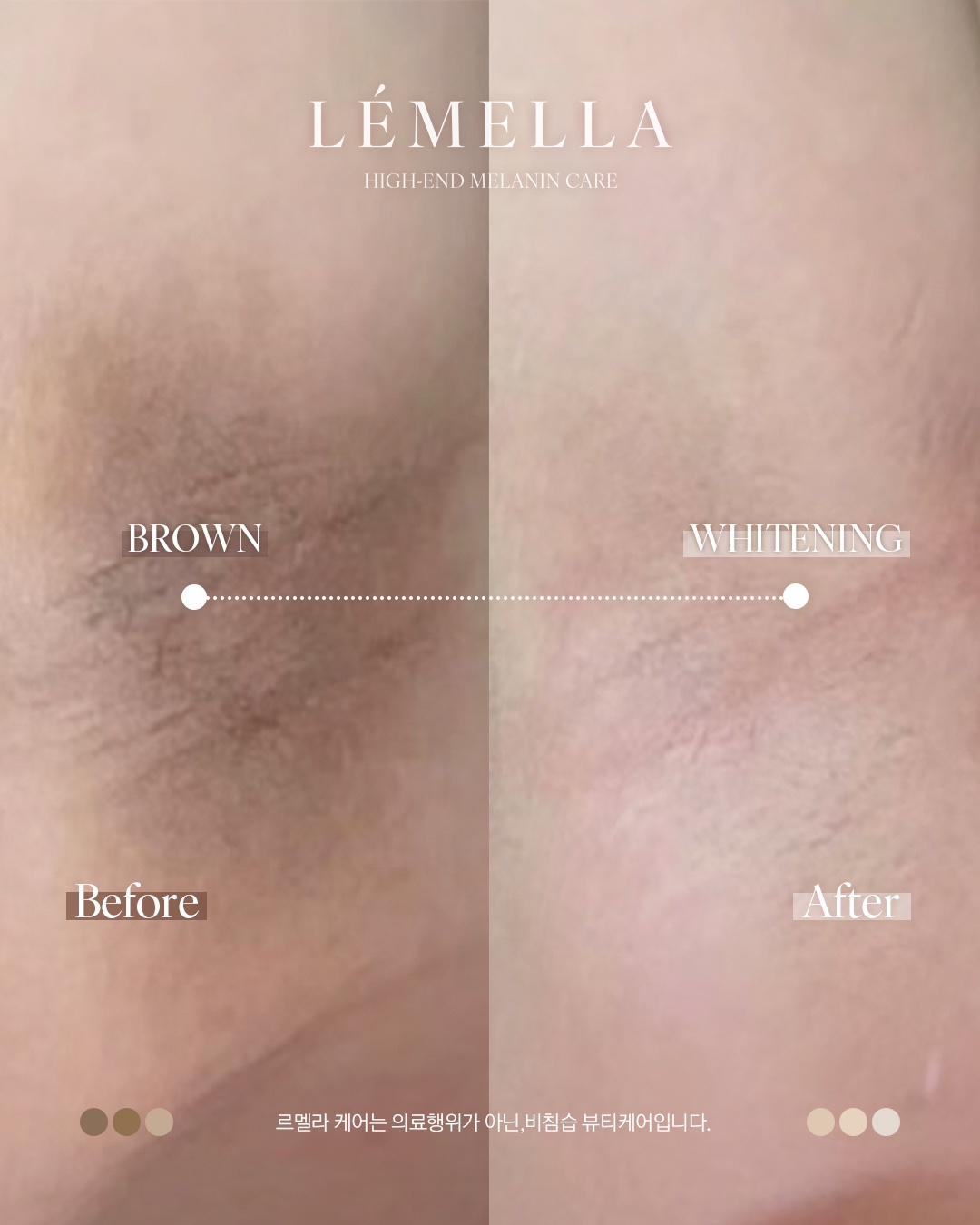 日本未上陸】最新メラニンケア・ルメラをご紹介！ | FOREVBROW